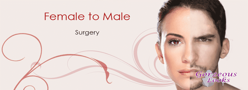 Female To Male Sex Surgery 102