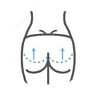 Butt Enlargement and Buttock Implant